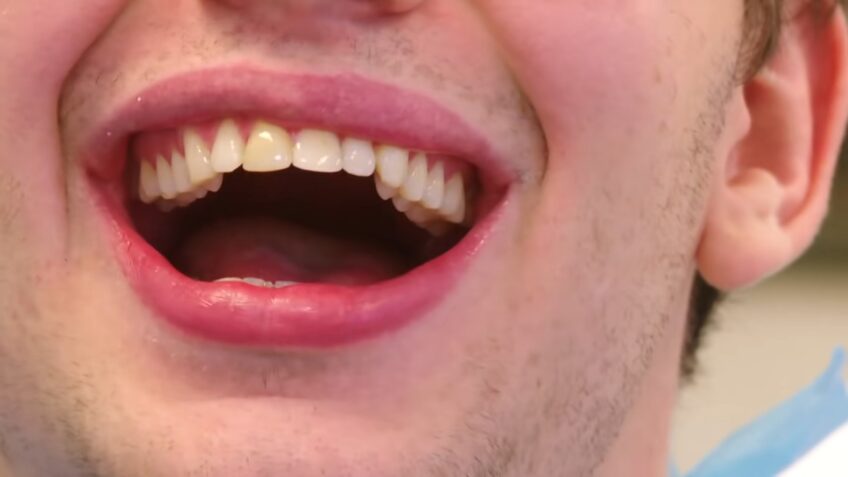 Teeth