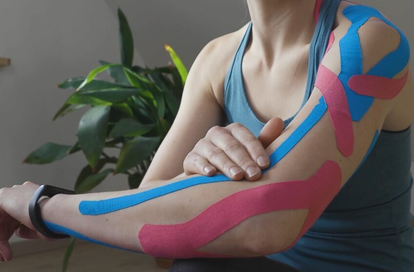 Kinesio tape application. (A) With tension (stabilizing effect): 2