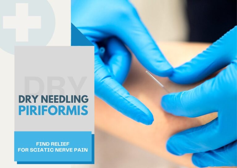 Dry Needling Piriformis Find Relief for Sciatic Nerve Pain