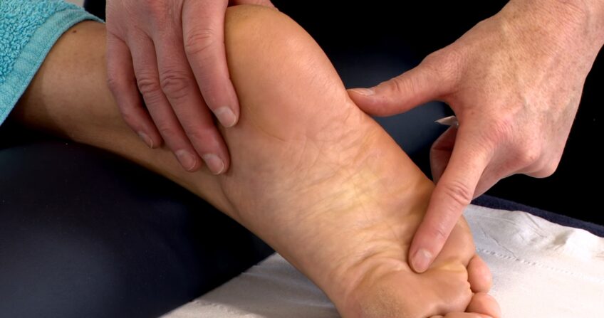 Plantar Fascia