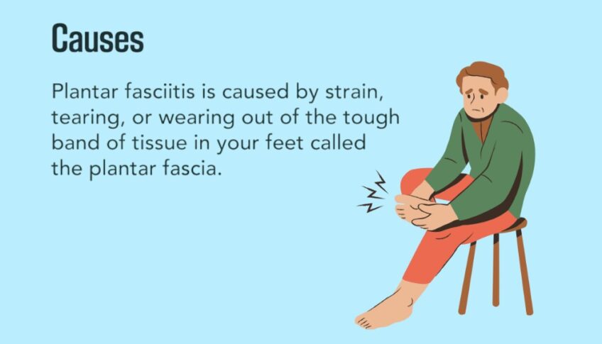 Plantar Fasciitis causes