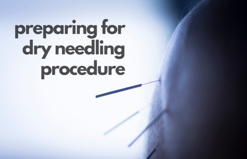 Preparing for dry needling Procedure