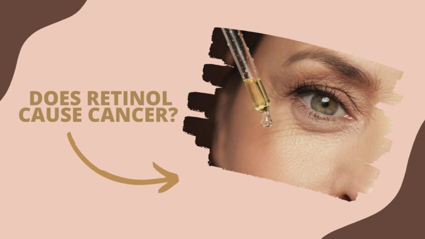 ortodoks hjerne Link Does Retinol Cause Cancer? Unveiling the Truth - Fischer Institute