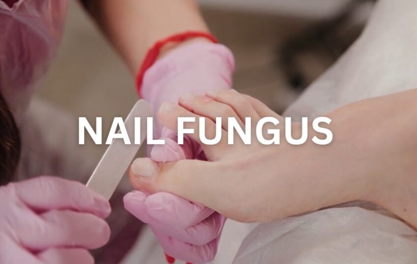 Why Does Nail Fungus Develop