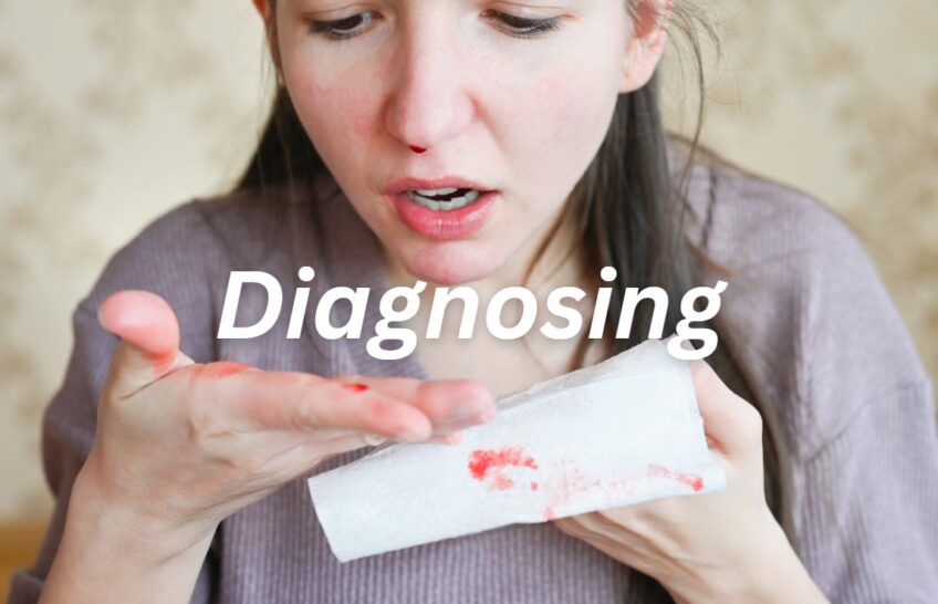 Diagnosing a Nosebleeds with Blood Clots