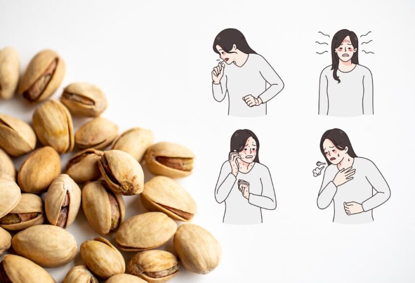 Nut Allergic Reactions