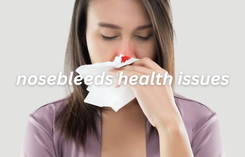 nosebleeds health issues