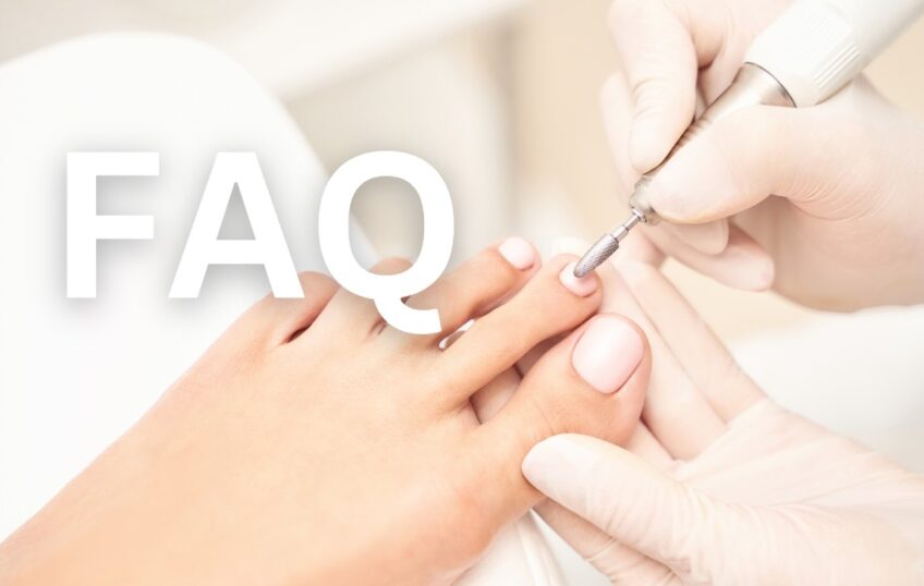 Nail Fungus faq