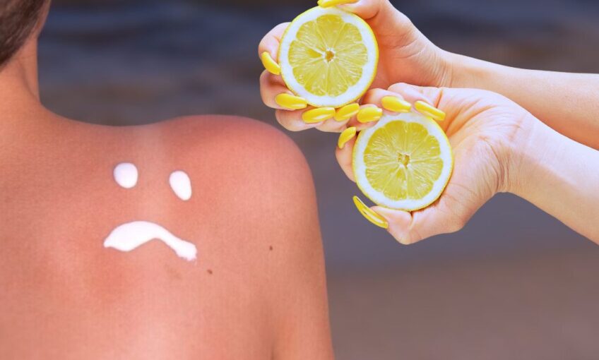 lemon water can trigger Sunburn 