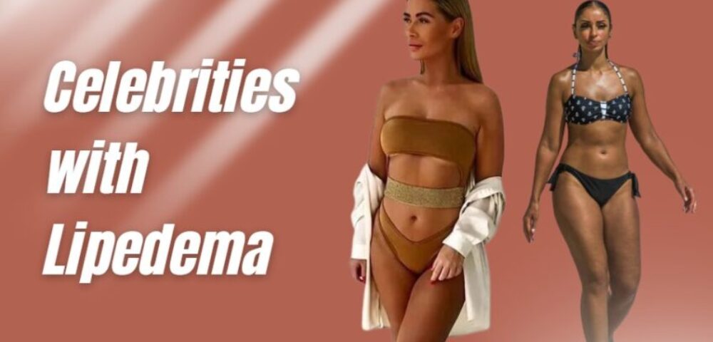 Celebrities with Lipedema
