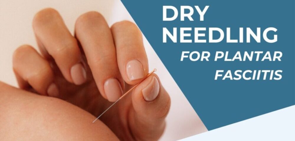 Dry Needling for Quadratus Plantae