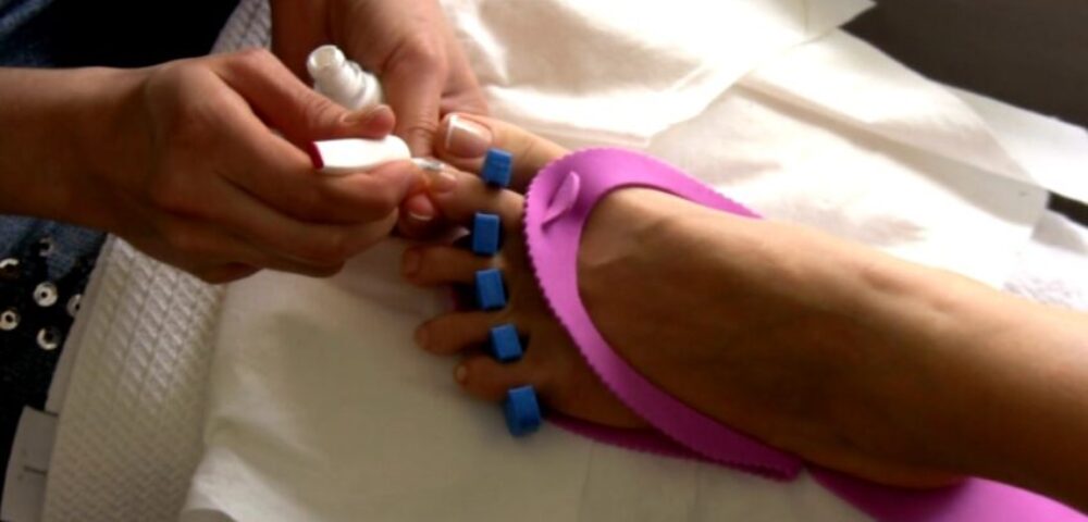 Pedicure if You Have Toenail Fungus