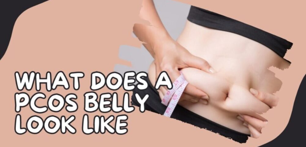 Polycystic ovary syndrome