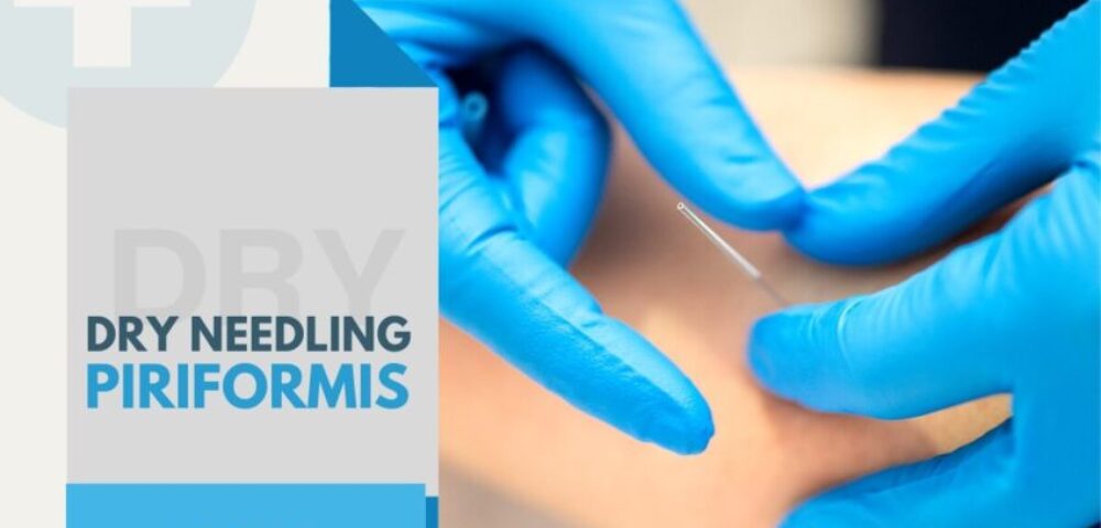 Sciatic Nerve Needling Piriformis 1