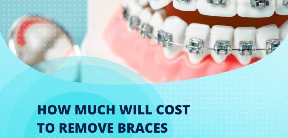 braces removal